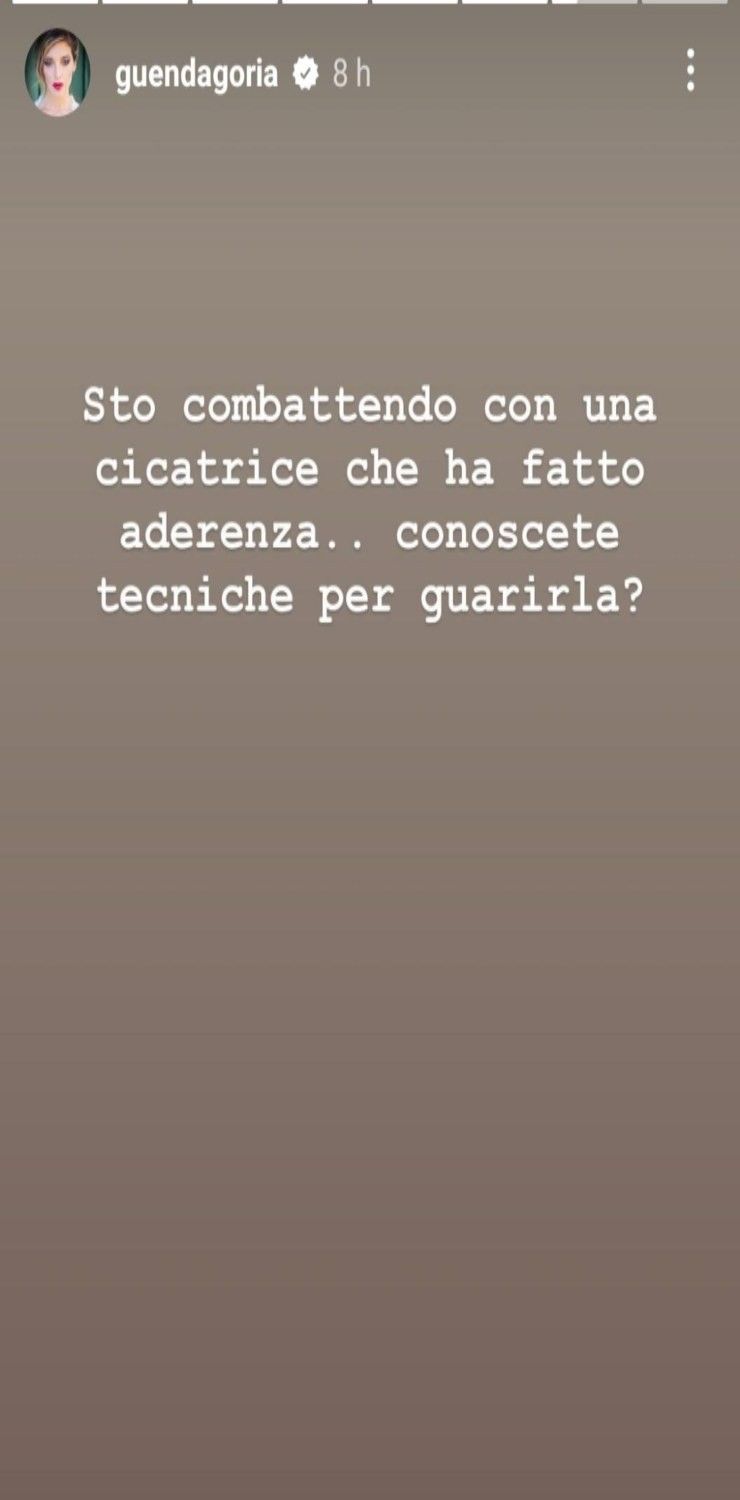 guenda goria nuovo problema-arlex.it